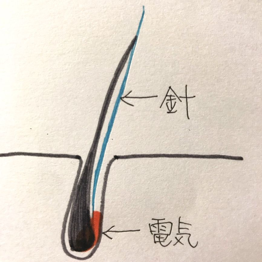平成と共に決別を決意したもの。それは、ひざ下のアレでした。のイメージ